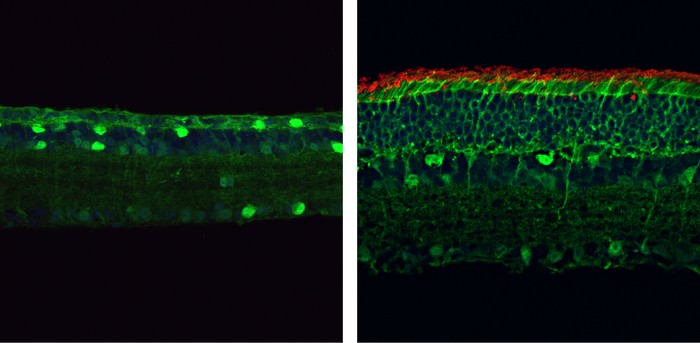 Retinas of mice before and after treatment with gene editing